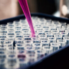diagnostic lab case